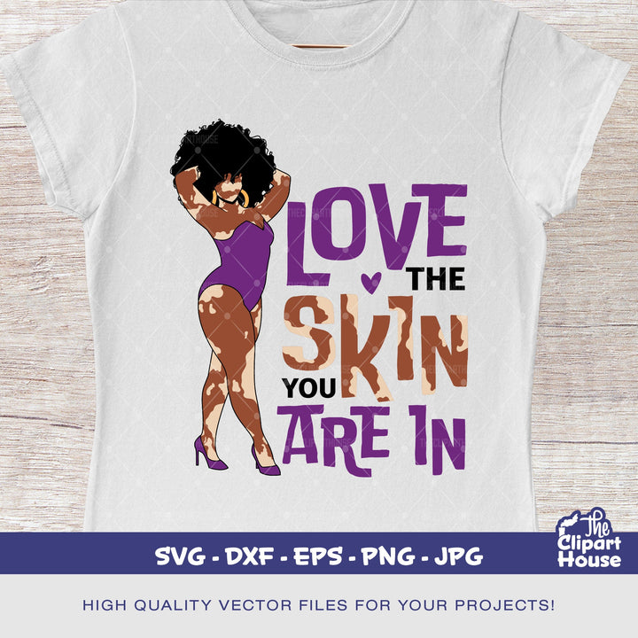 Vitiligo Black Woman Love Your Skin, african american svg, black woman svg, black girl svg, melanin svg, afro girl svg, vitiligo day - The Clipart House